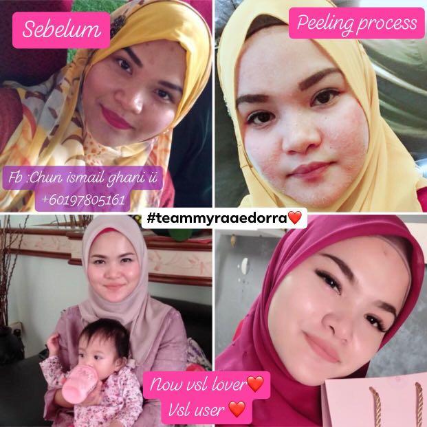 Vsl Skincare Health Beauty Face Skin Care On Carousell