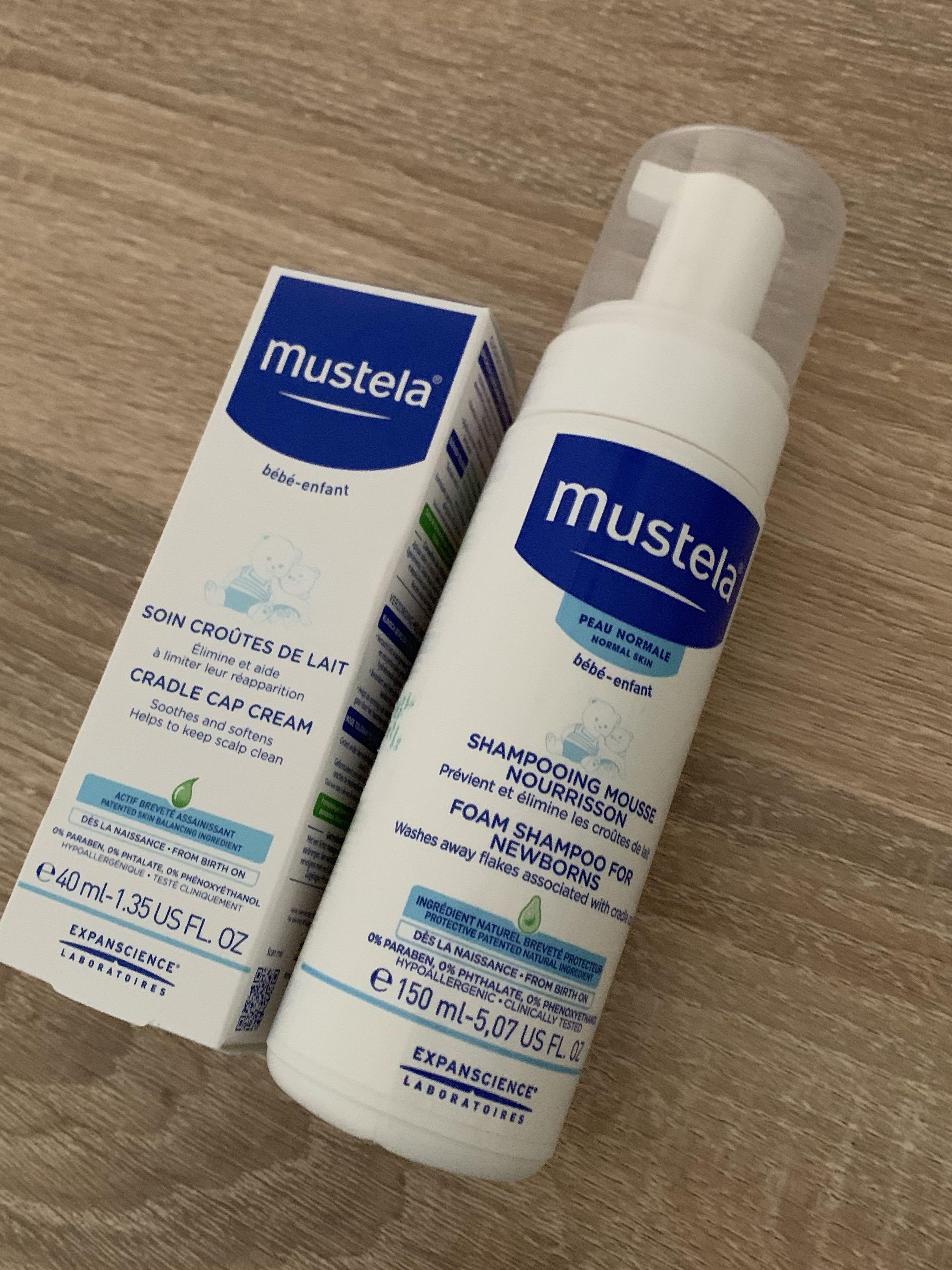 cradle cap cream for babies