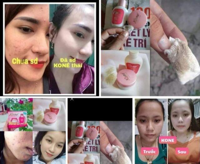 keburukan kone skincare