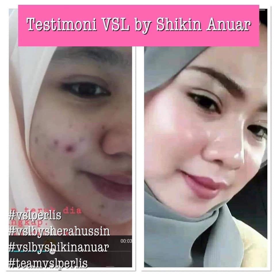 Vsl Skincare Testimoni