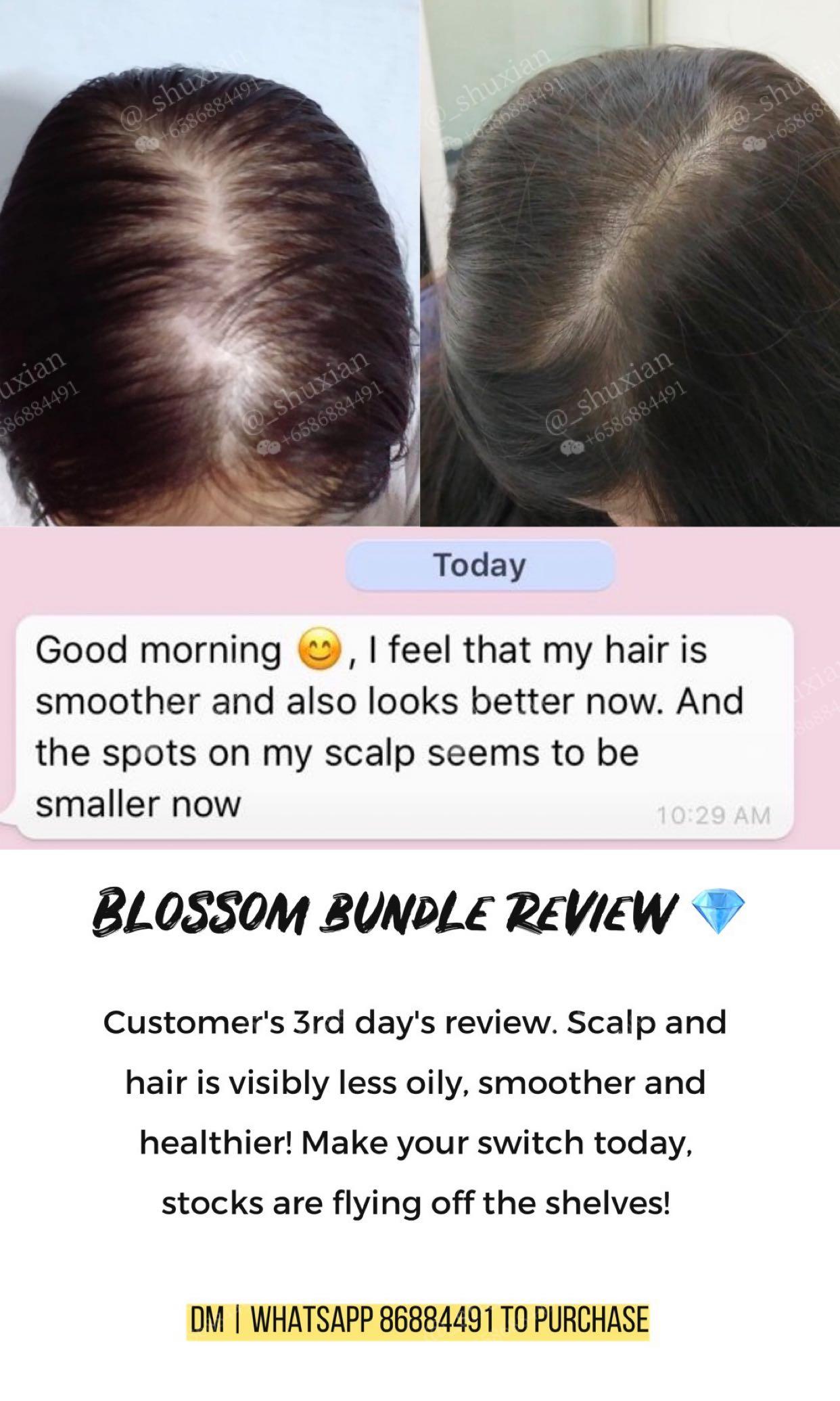 Dixmondsg Hair Care Series On Carousell
