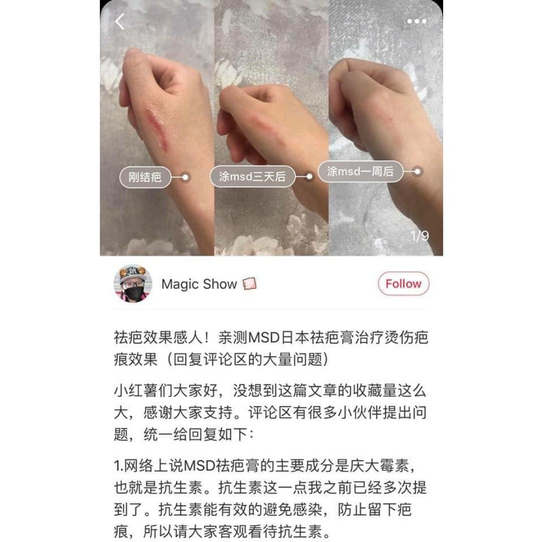 Japan MSD Scar Removal Cream 10g, Beauty & Personal Care, Face, Face