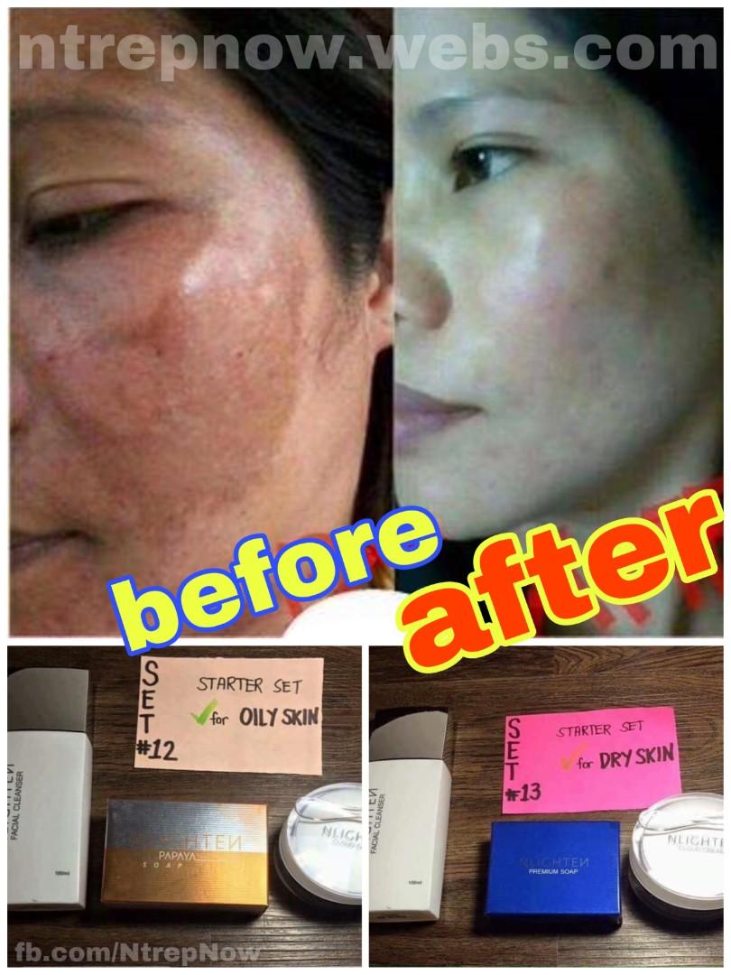 korean products for dark spots
