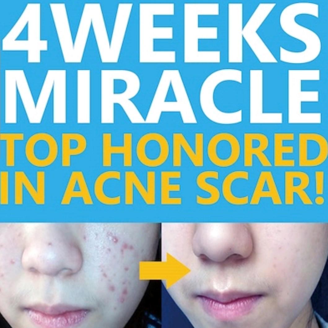 scar free face cream