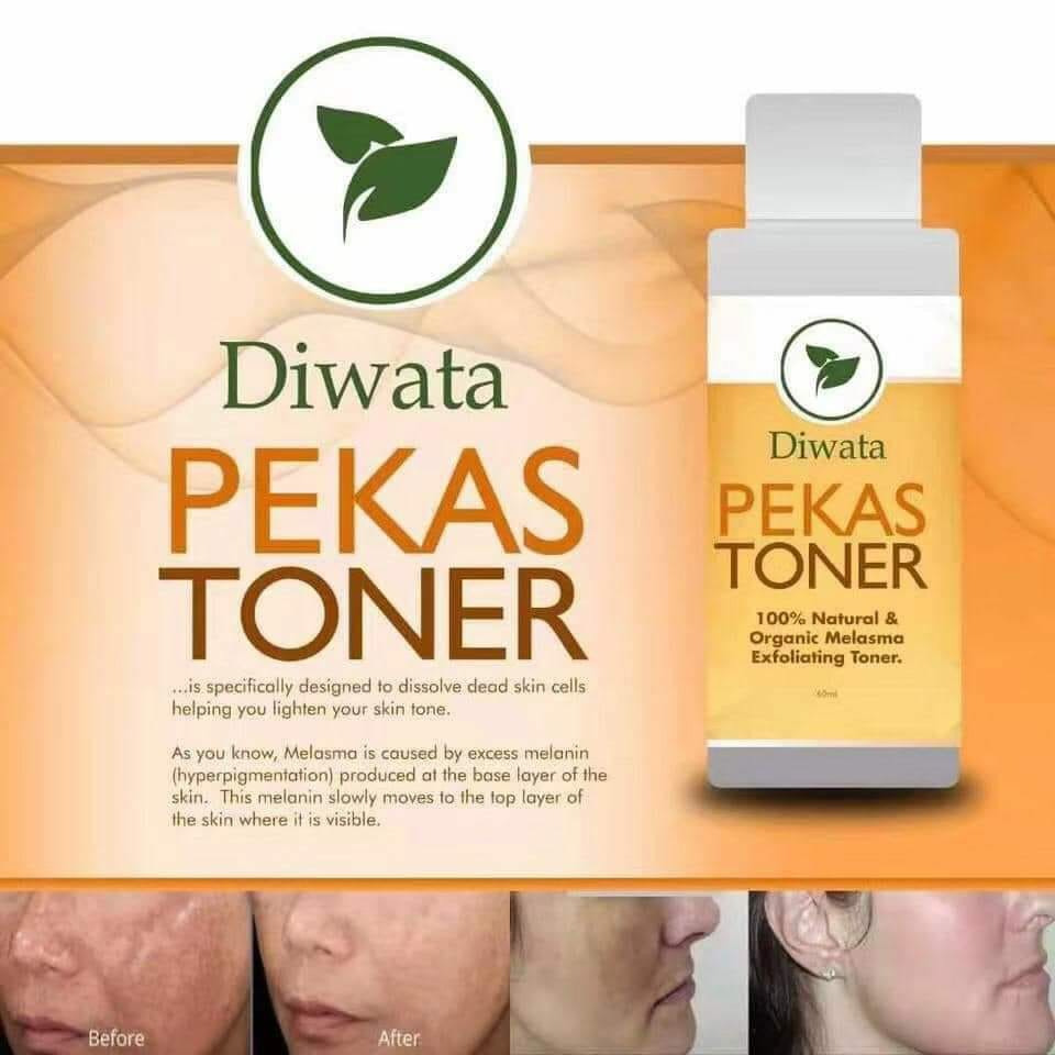 toner for melasma