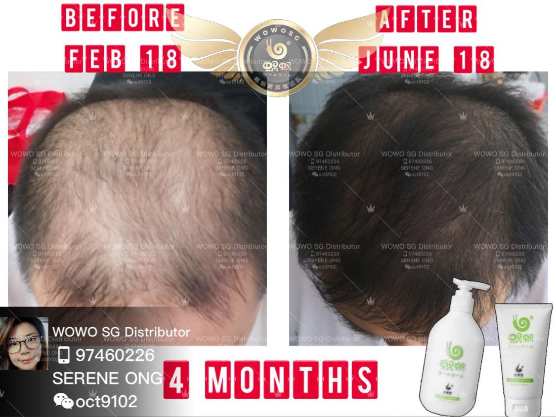 Wouwou Pure Ginger Anti Hairloss Shampoo Removes Oily Scalp