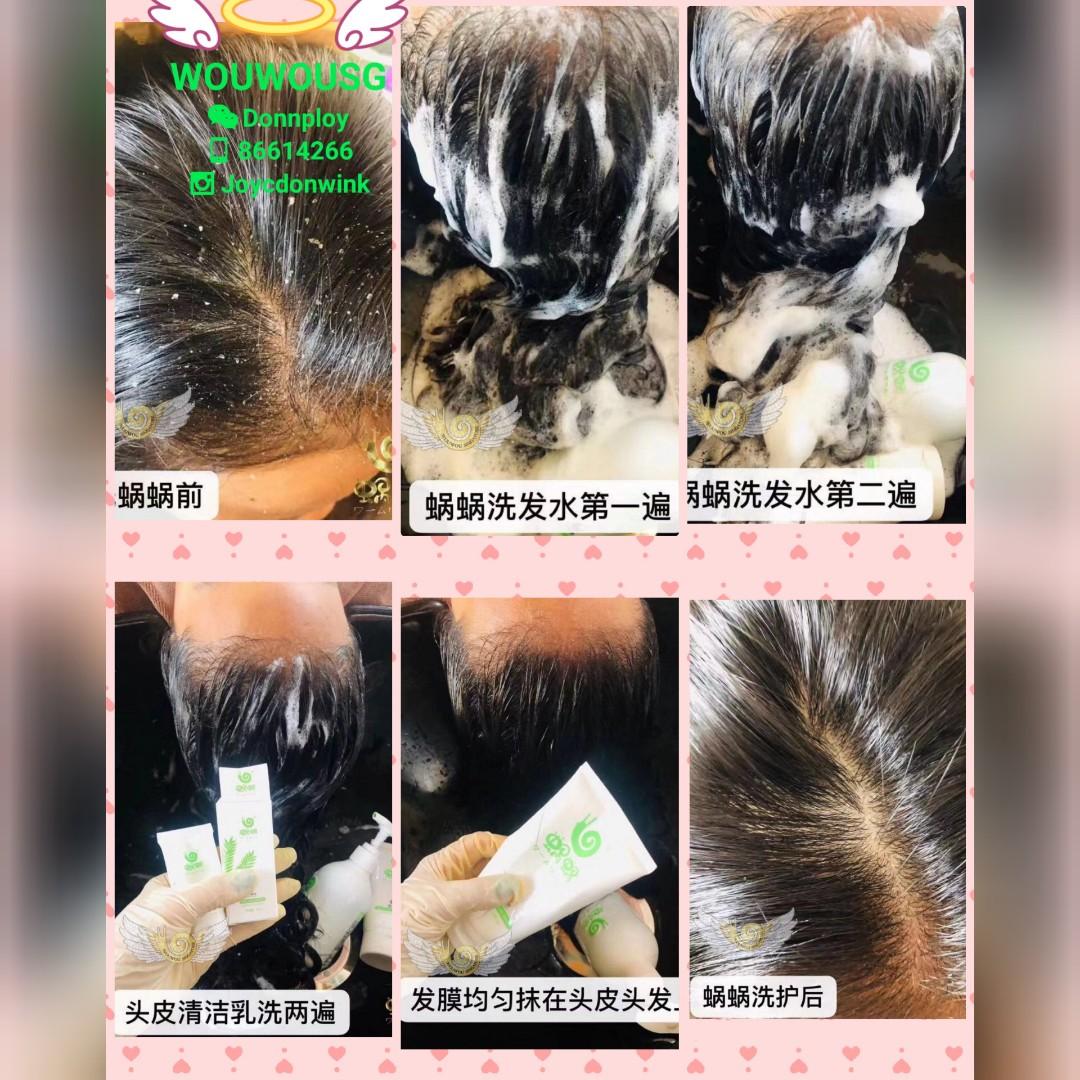 Wowo Hair Series Cure Flaky Druff Away Of Your Hair West Side