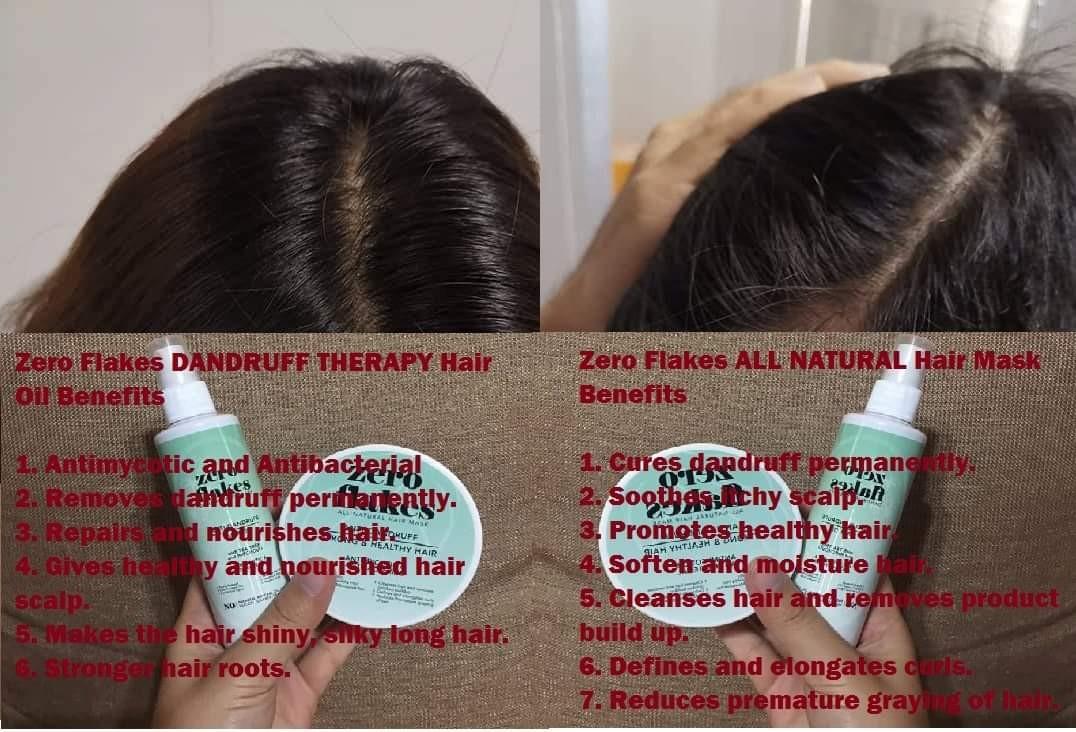 Zero Flakes Dandruff Removal Products On Carousell