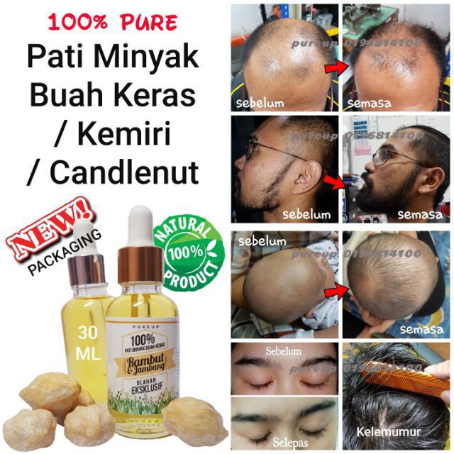 Tonik Lebat Rambut Buah Keras Everything Else Others On Carousell