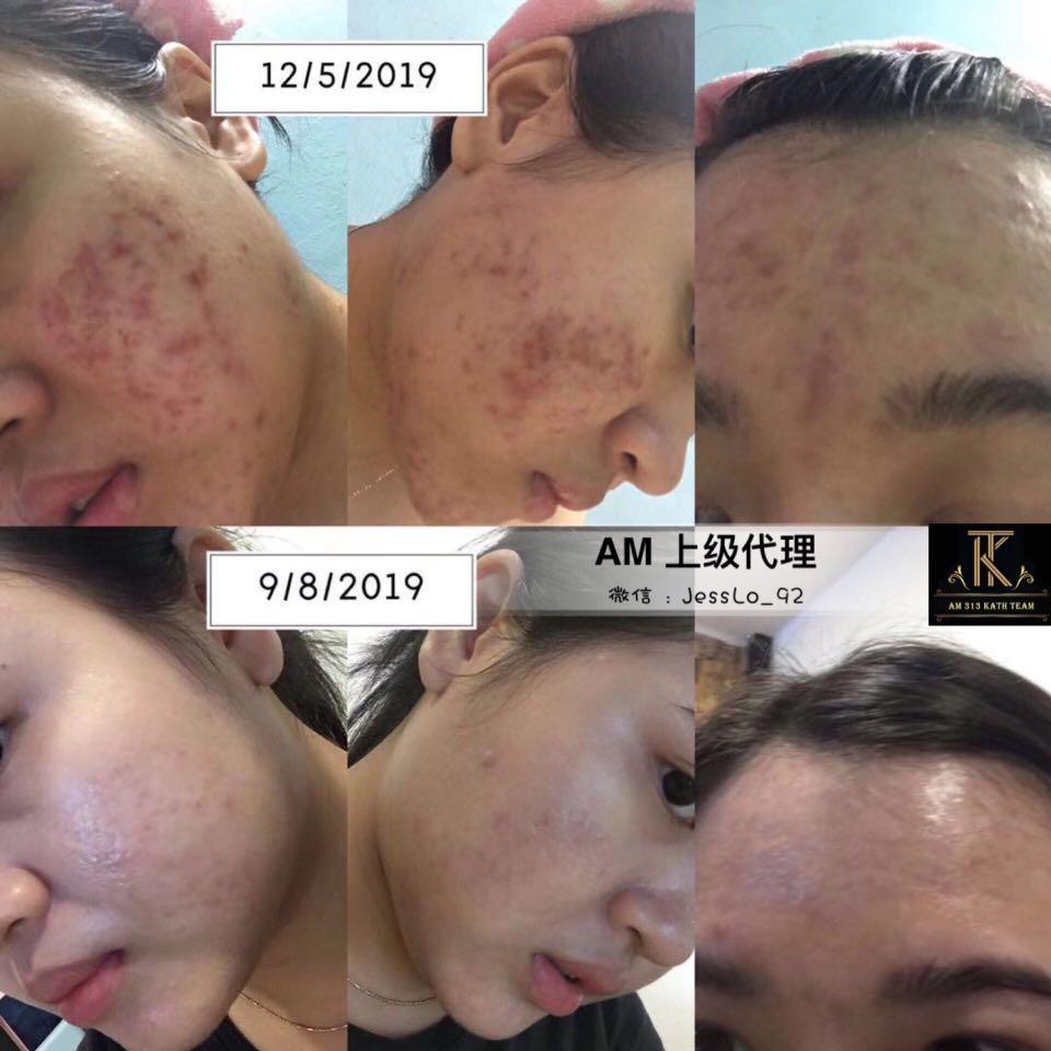 Am Professional Skin Care Health Beauty Face Skin Care On Carousell