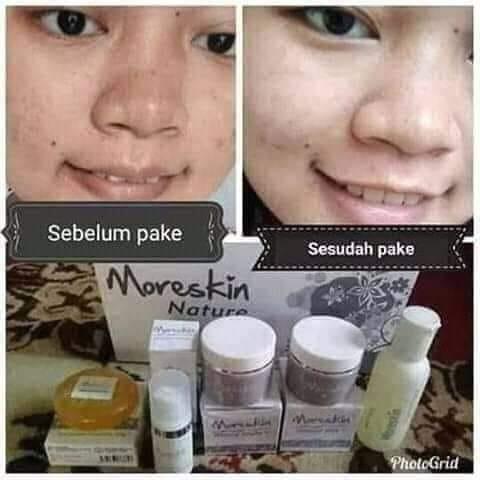 Moreskin nature store