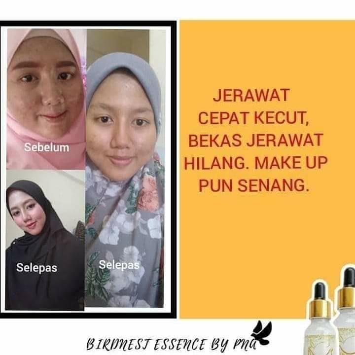 Bird S Nest Essence Serum Face Treatment Serum Bird Nest Serum Health Beauty Face Skin Care On Carousell