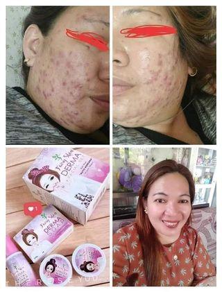 Fairy Skin Glowing Set Skin Bath Body Carousell Philippines