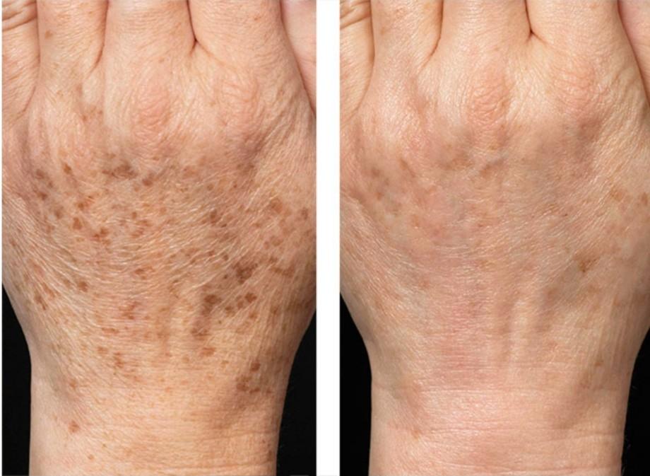 KPEM AGING SPOTS HAND CREAM, Beauty & Personal Care, Foot ...