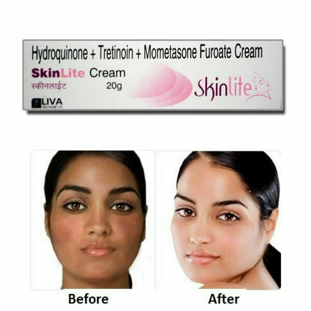 hydroquinone face cream