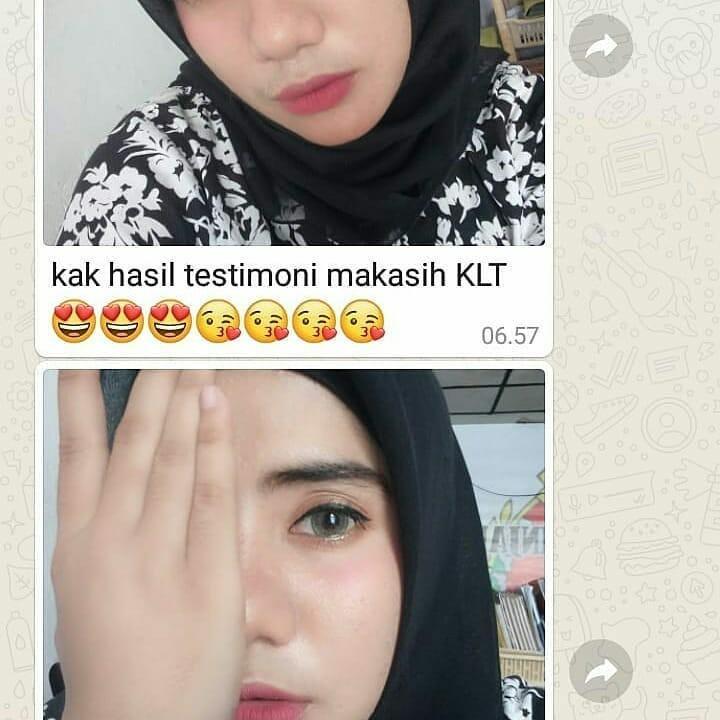 Cream Kalimantan Cek Review Kesehatan Kecantikan Kulit Sabun Tubuh Di Carousell