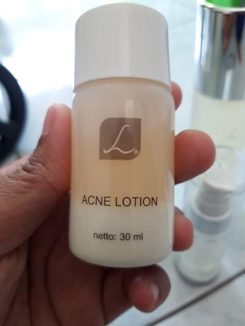 Acne Lotion Larissa Kesehatan Kecantikan Rias Wajah Di Carousell