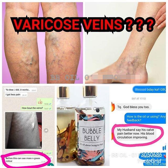 Bubble Belly Oil Health Beauty Hand Foot Care On Carousell