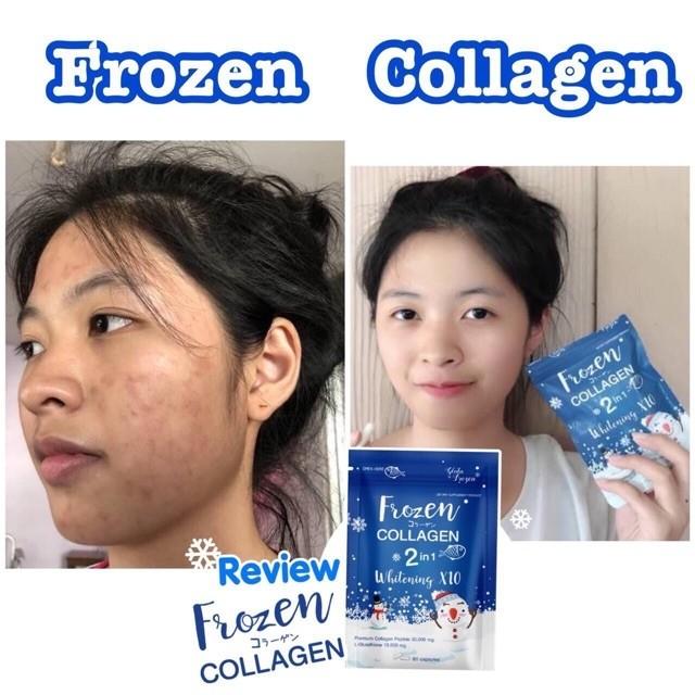 Frozen Collagen Original Original 60capsules Health Beauty Skin Bath Body On Carousell Frozen Collagen Original Original 60capsules Health Beauty Skin Bath Body On Carousell