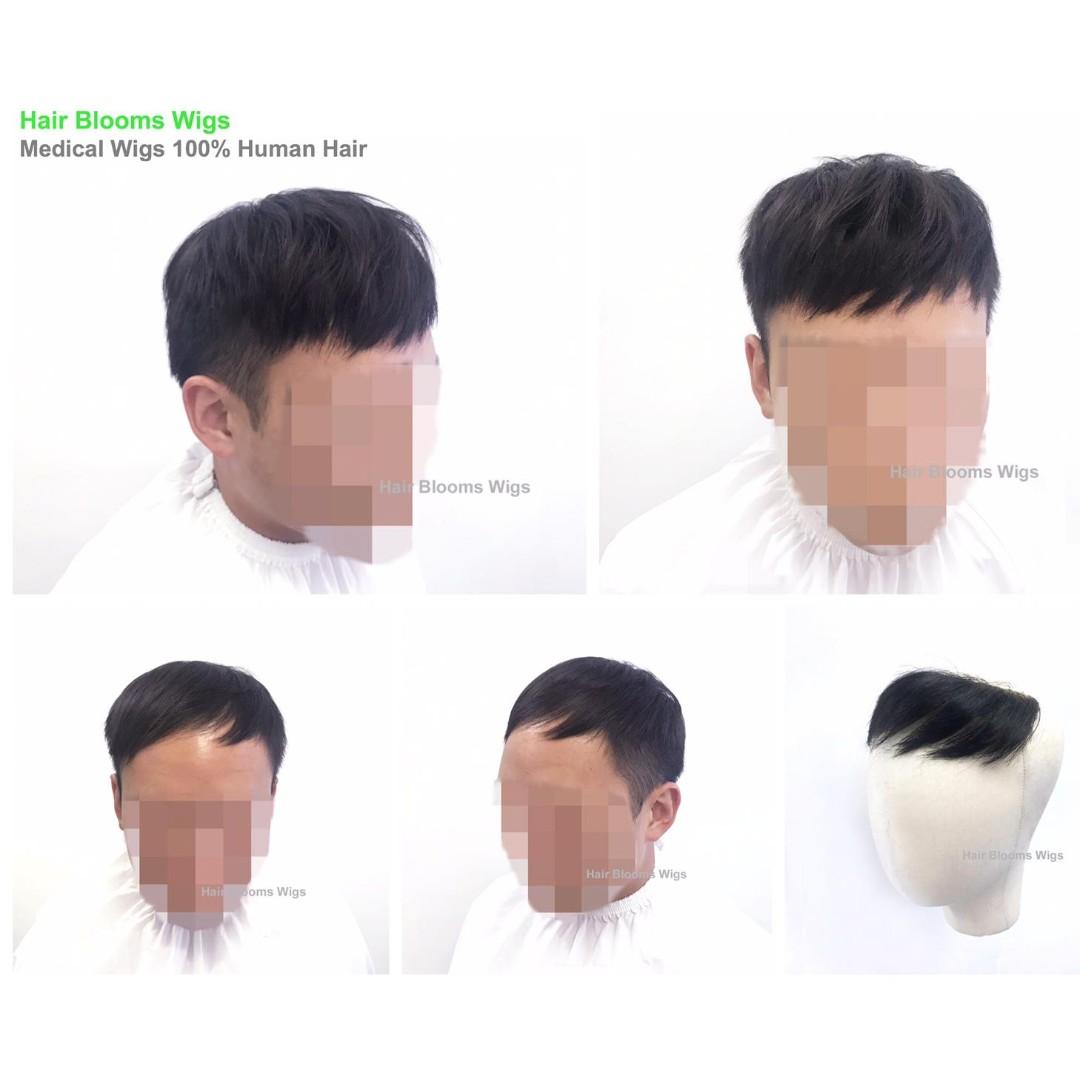 Hair Blooms Wigs 男士髮片 M字額 Men S Hairpiece M Shape 專為脫髮人士改善型像 男裝 男裝配飾 Carousell