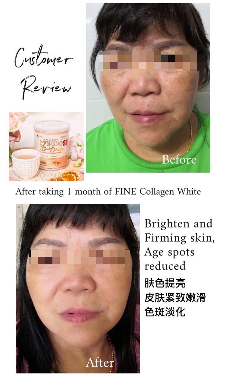 Fine Collagen White On Carousell