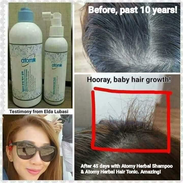 Atomy Saengmodan Hair Tonic, Beauty & Personal Care, Hair on Carousell