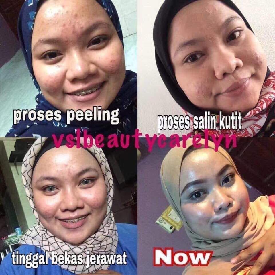 Vsl Skincare Health Beauty Face Skin Care On Carousell