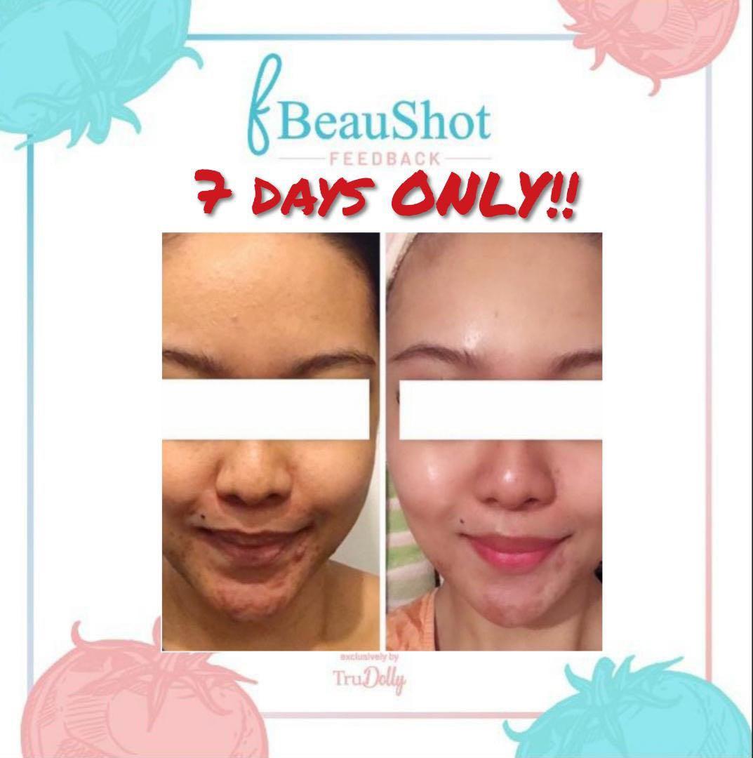 skin care fazura