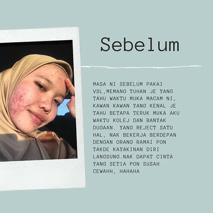 Vsl Beauty Care Kkm Shiranase