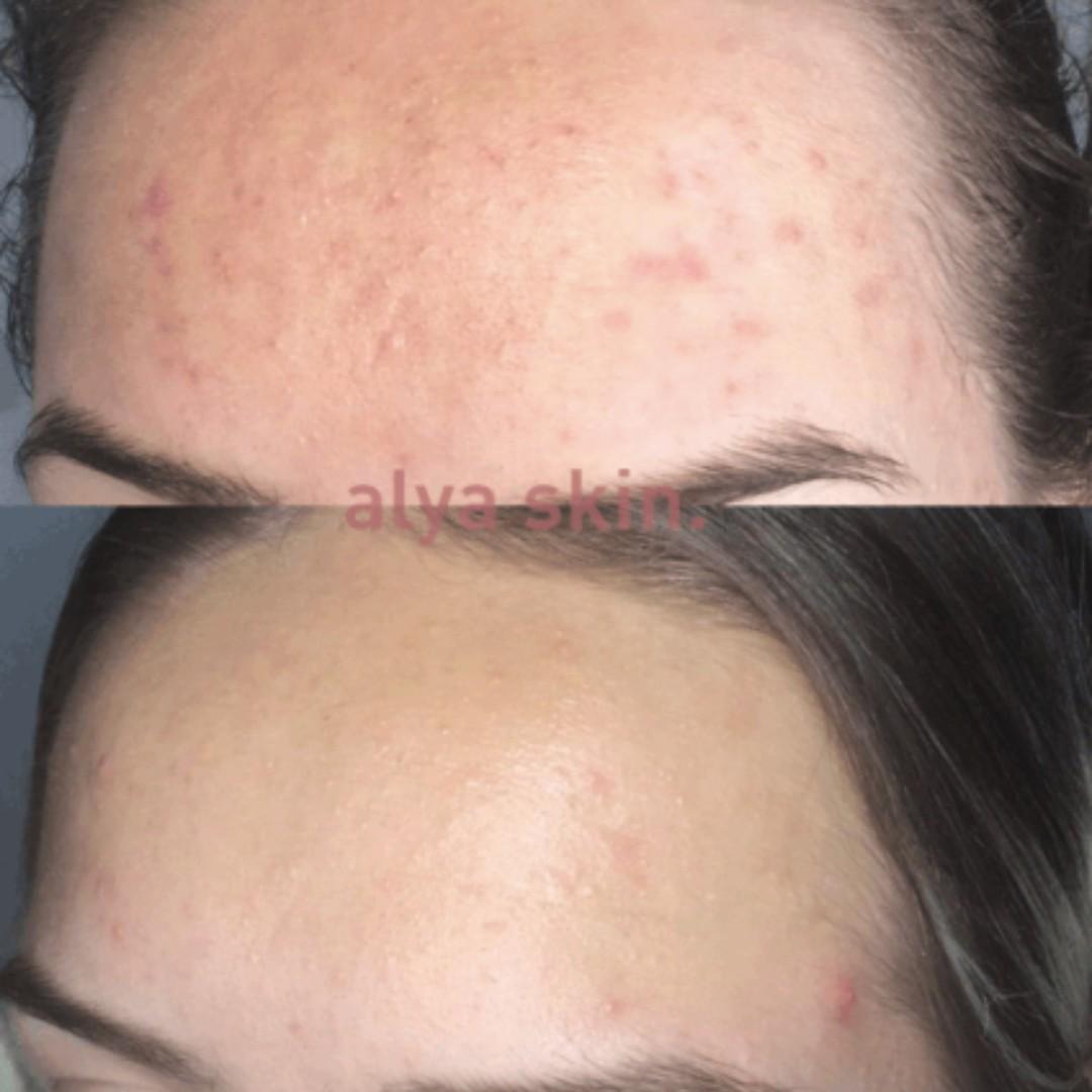 alya skin products reviews