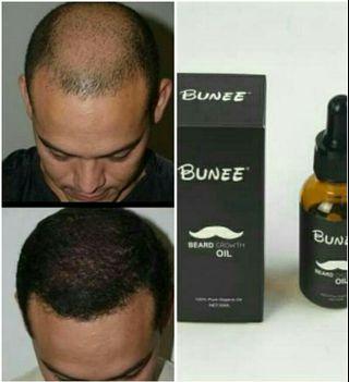 Rambut Cepat Panjang Hair Care Carousell Malaysia