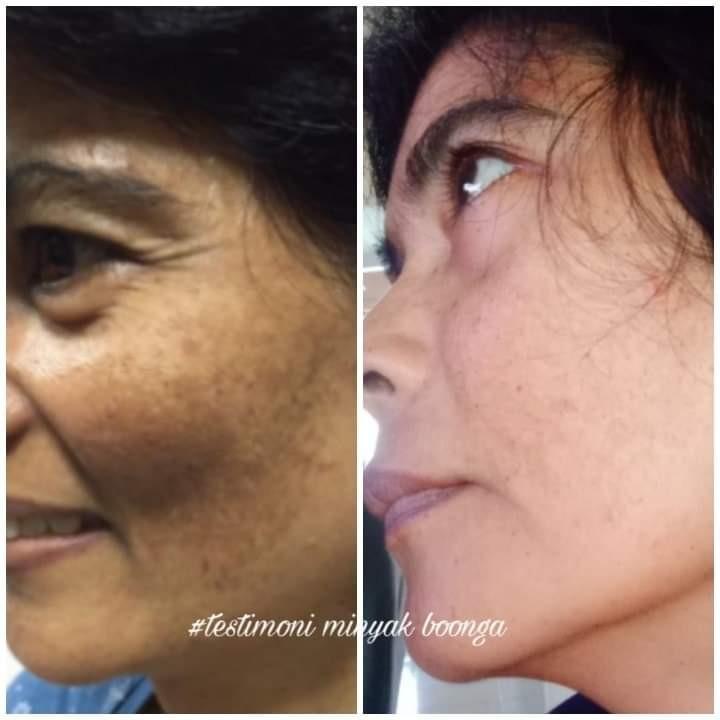 Minyak Boonga by Aifa Cosmetics, Beauty & Personal Care, Face, Face ...