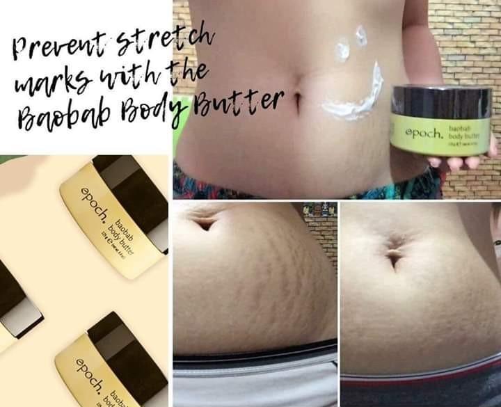 NU SKIN Baobab Butter (Category: Health Food, Drinks & Tonics) located in Pasig City. Submitted by iamblessed88 (Listing ID 261514046, Image 3). Description: OnHAND and ON SAlE! sale SALE! SAVE php 300 when you Order from me Beautify and Pamper your SKIN with this Epoch Baobab Body Butter 🍀 The Baobab Body butter is amazing for your skin in so many ways, such as: 👉 It reduces the appearance of stretch marks 👉 Helps tone your skin, leaving it f