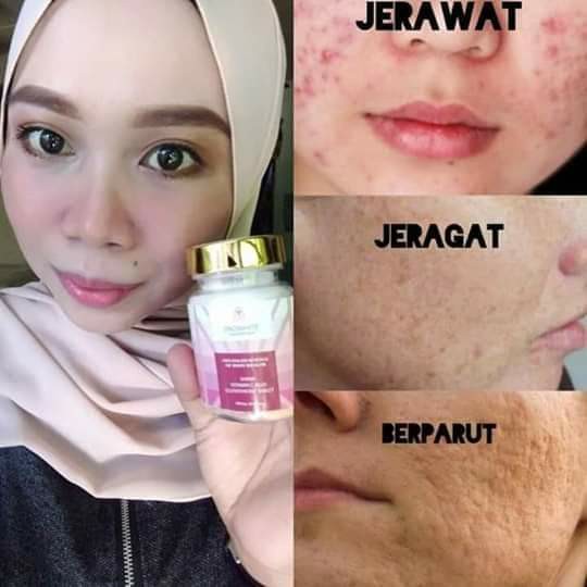 Snow White Chewable Tablets Whitening Jamu Beauty Personal Care Face Makeup On Carousell