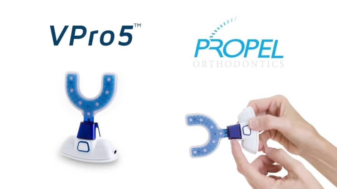 Vpro For Invisalign Propel v pro 5 orthodontics aligner seating device, Health & Nutrition ...