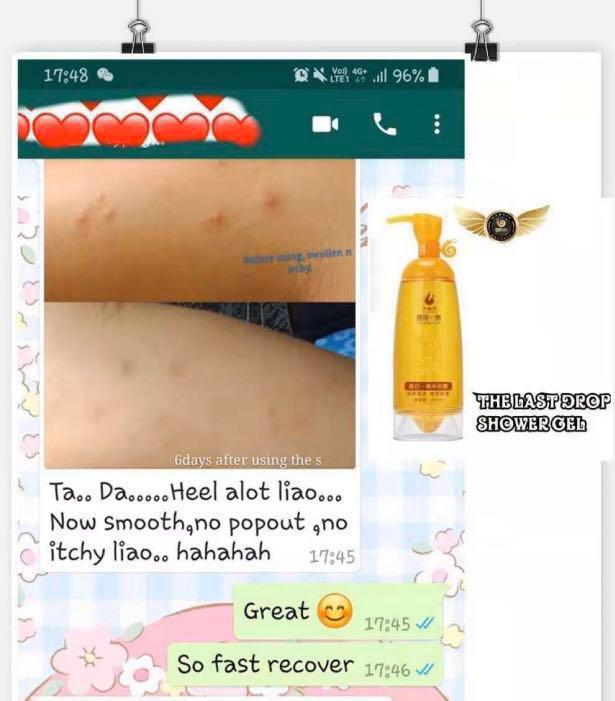 Ezcema Skin / Sensitive Skin / psoriasis Shower Gel , Beauty