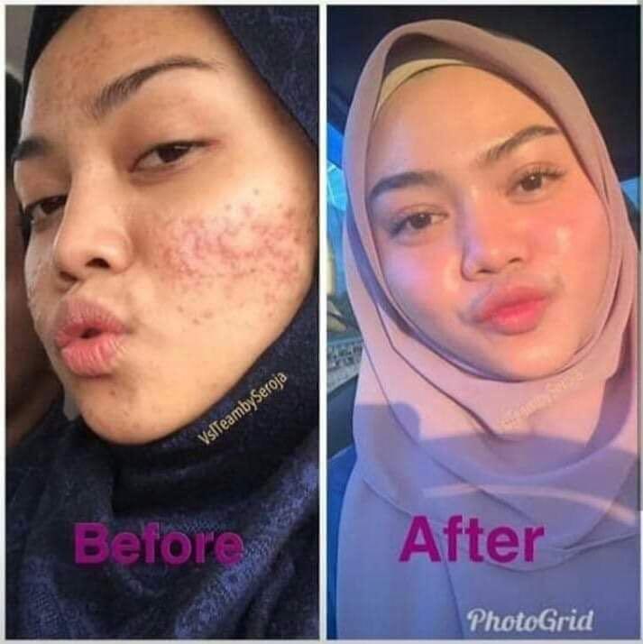 Vsl Skincare Health Beauty Face Skin Care On Carousell