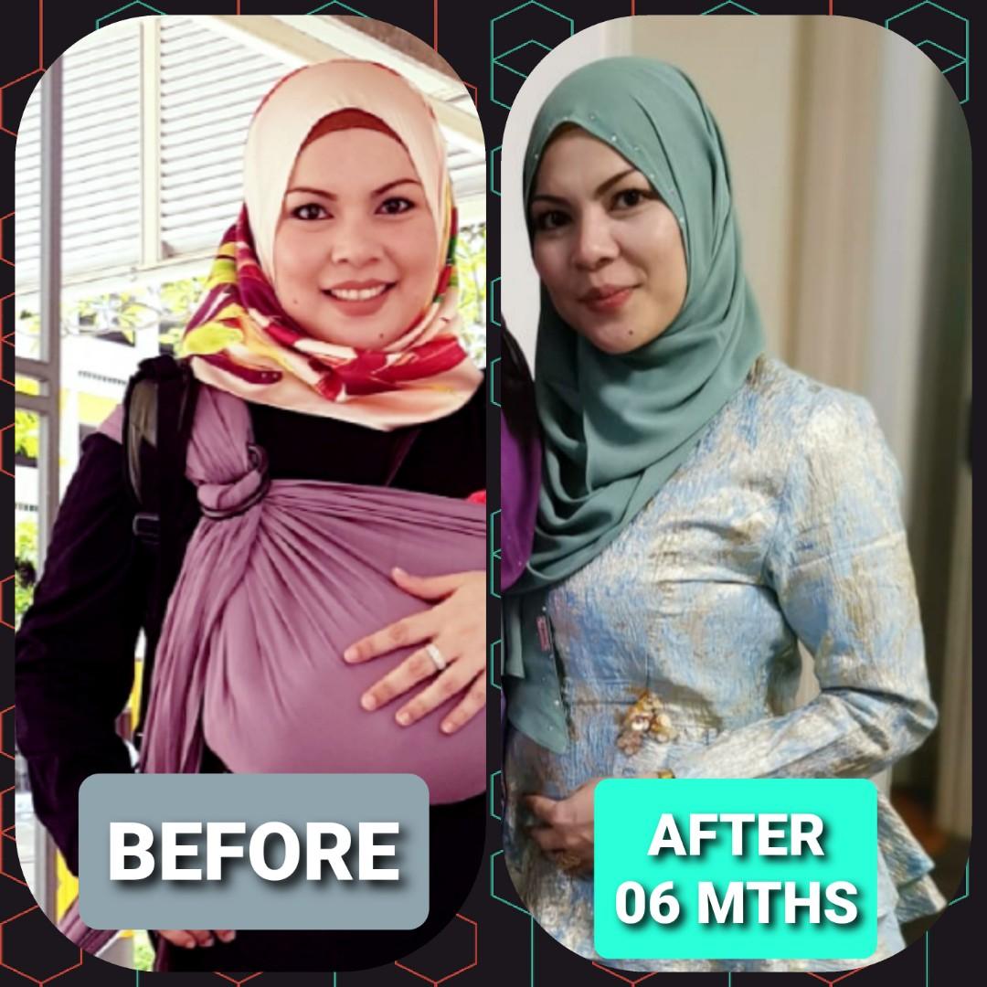 Solid Molid By Ifa Raziah Health Nutrition Health Supplements Health Food Drinks Tonics On Carousell