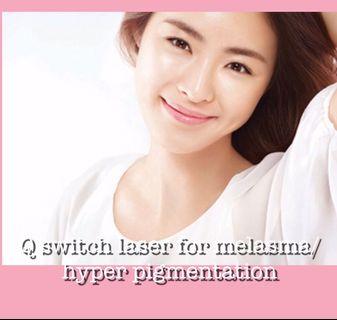 Q Switch Laser for melasma, hyper pigmentation $80