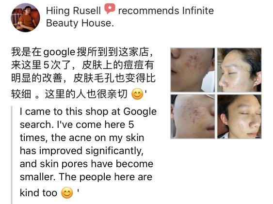 personalised acne treatment