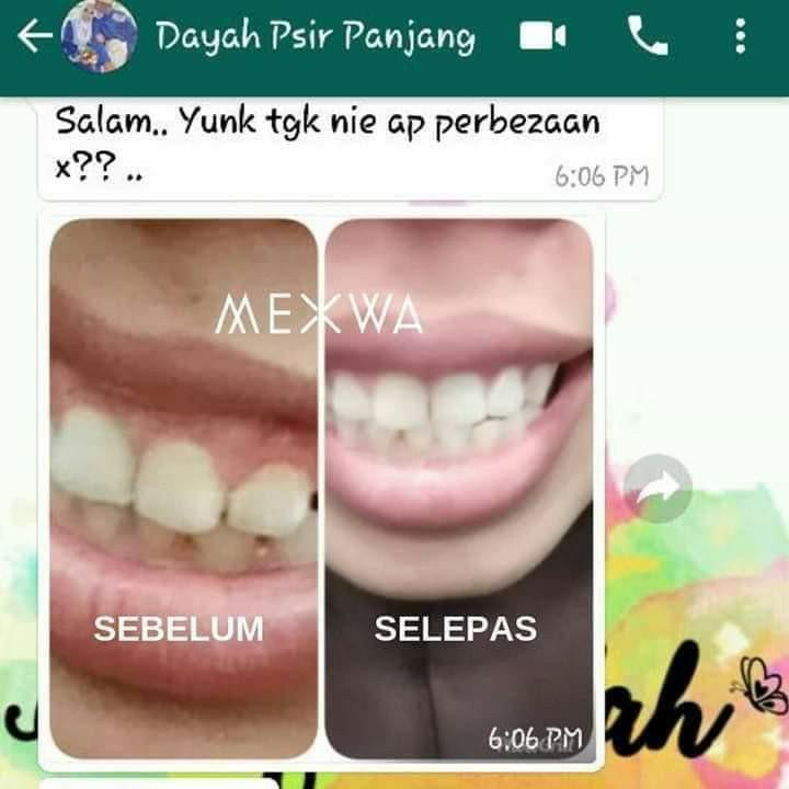 Mexwa Teeth Whitening Pen Pemutih Gigi Everything Else On Carousell