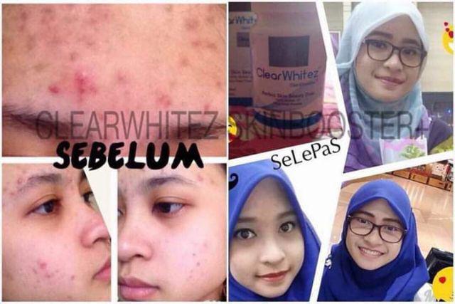 clear white skin booster