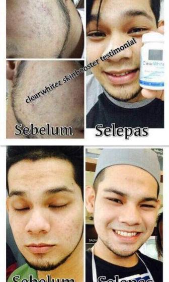 Clear whitez skin hotsell booster