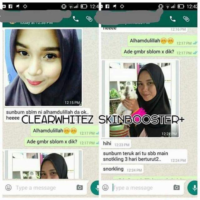 clear whitez skin booster