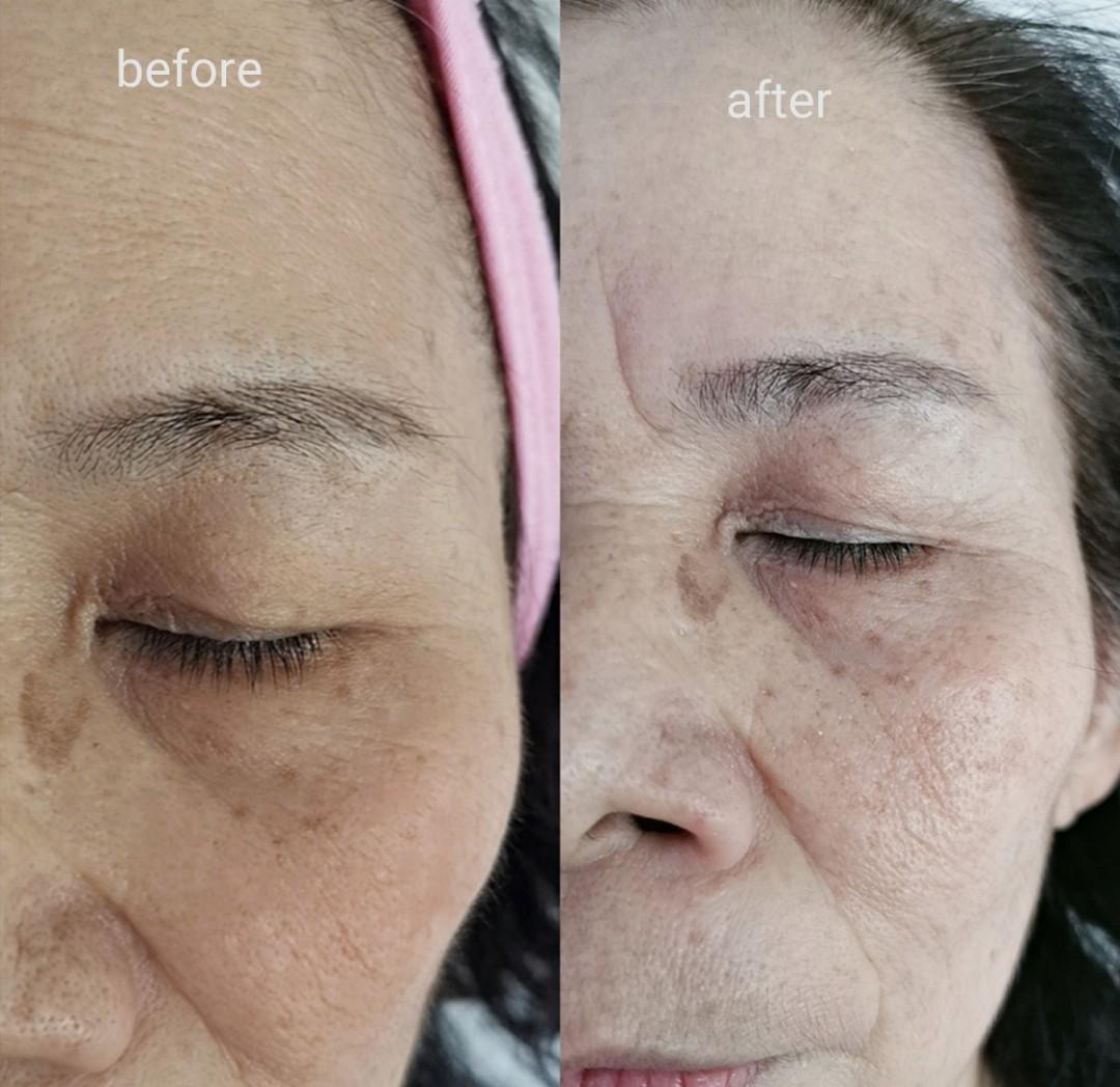 Bb glow skin treatment/facial (Category: Beauty & Health Services) located in Singapore. Submitted by abjoint (Listing ID 279539870, Image 1). Description: First trial $58 (U.P$88) BB glow skin treatment 60mins Location Clementi Ave 6.