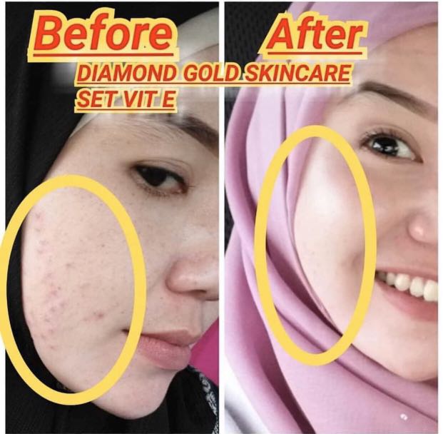 set diamond gold skincare