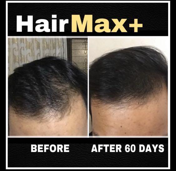 Hair max sales plus results