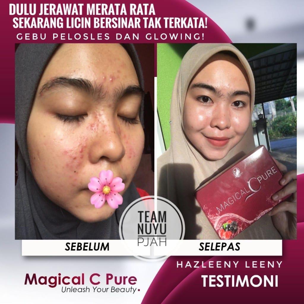 Magical C Pure Feedback Health Beauty Skin Bath Body On Carousell
