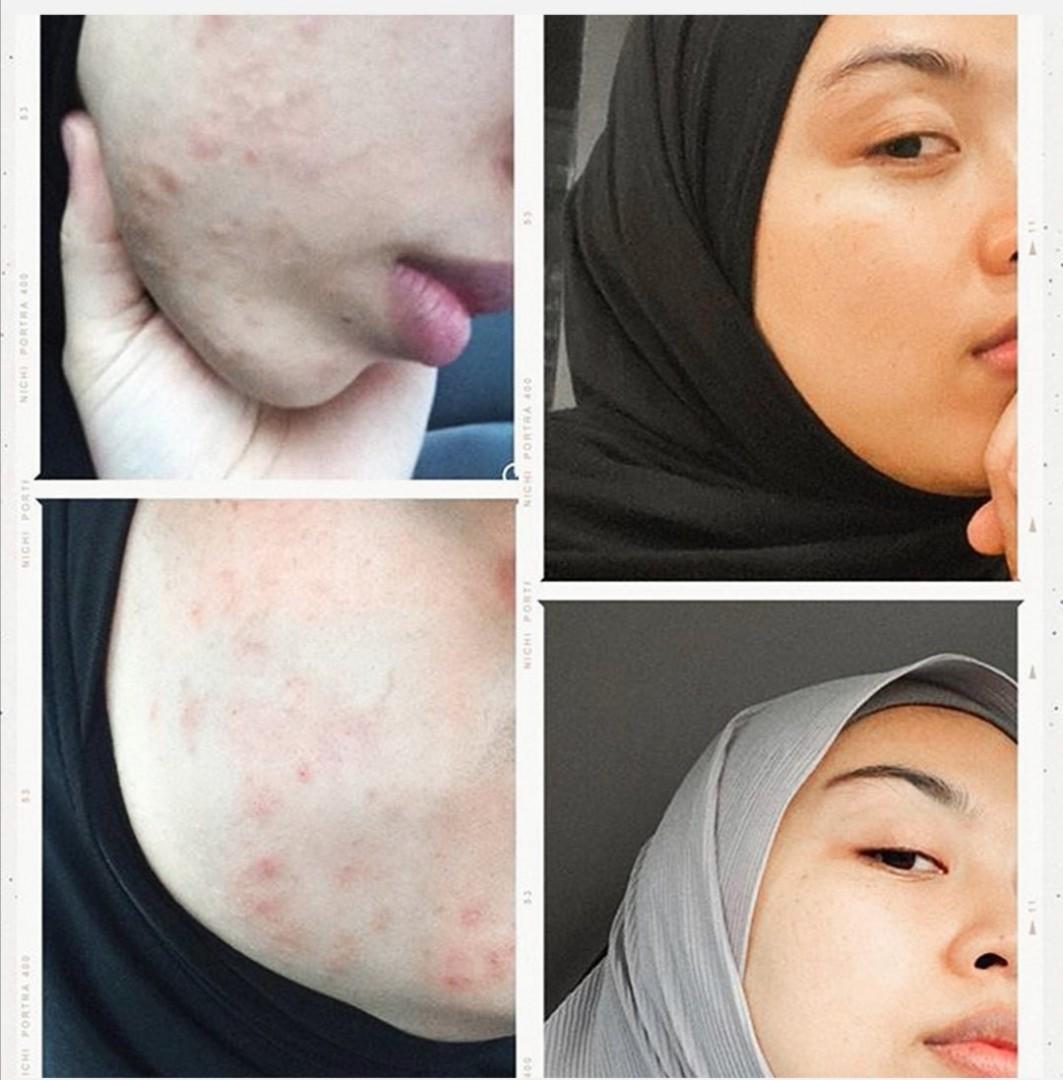 Bougas Beauty Advanced Serum Beauty Personal Care Face Face Care On Carousell