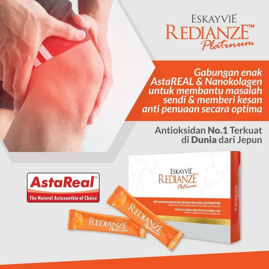 Eskayvie Redianze Platinum Everything Else On Carousell